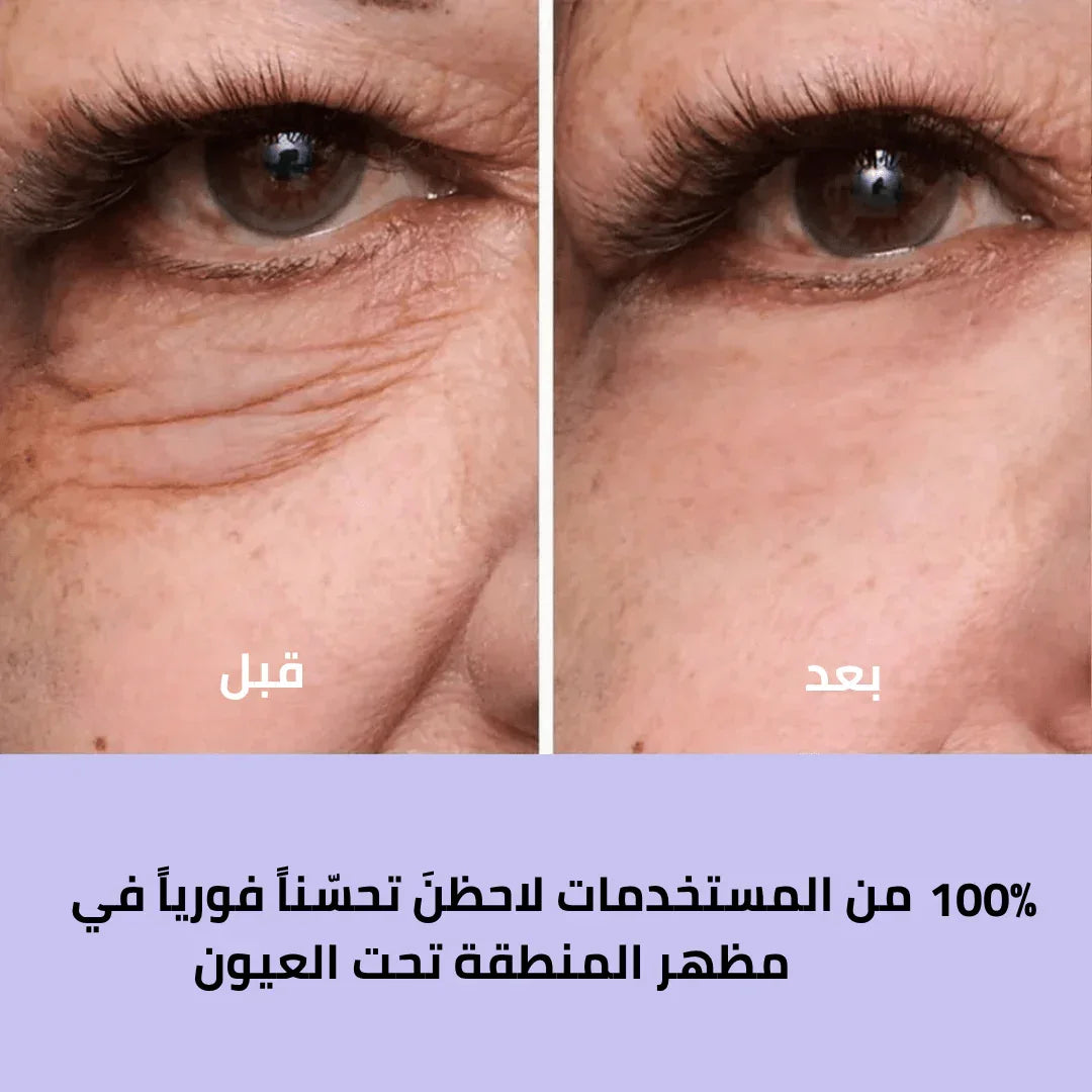 كريم شد العيون سر الجمال الشاب الذي يعيد لكِ إشراقة الثقة والحيوية - aynaya ❤️