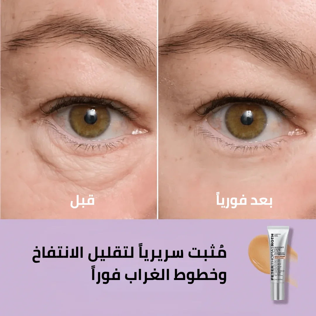 كريم شد العيون سر الجمال الشاب الذي يعيد لكِ إشراقة الثقة والحيوية - aynaya ❤️