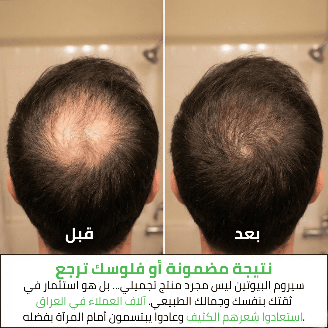 سيروم البيوتين السحري لإعادة حيوية شعرك وملء الفراغات - aynaya ❤️