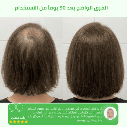 سيروم البيوتين السحري لإعادة حيوية شعرك وملء الفراغات - aynaya ❤️