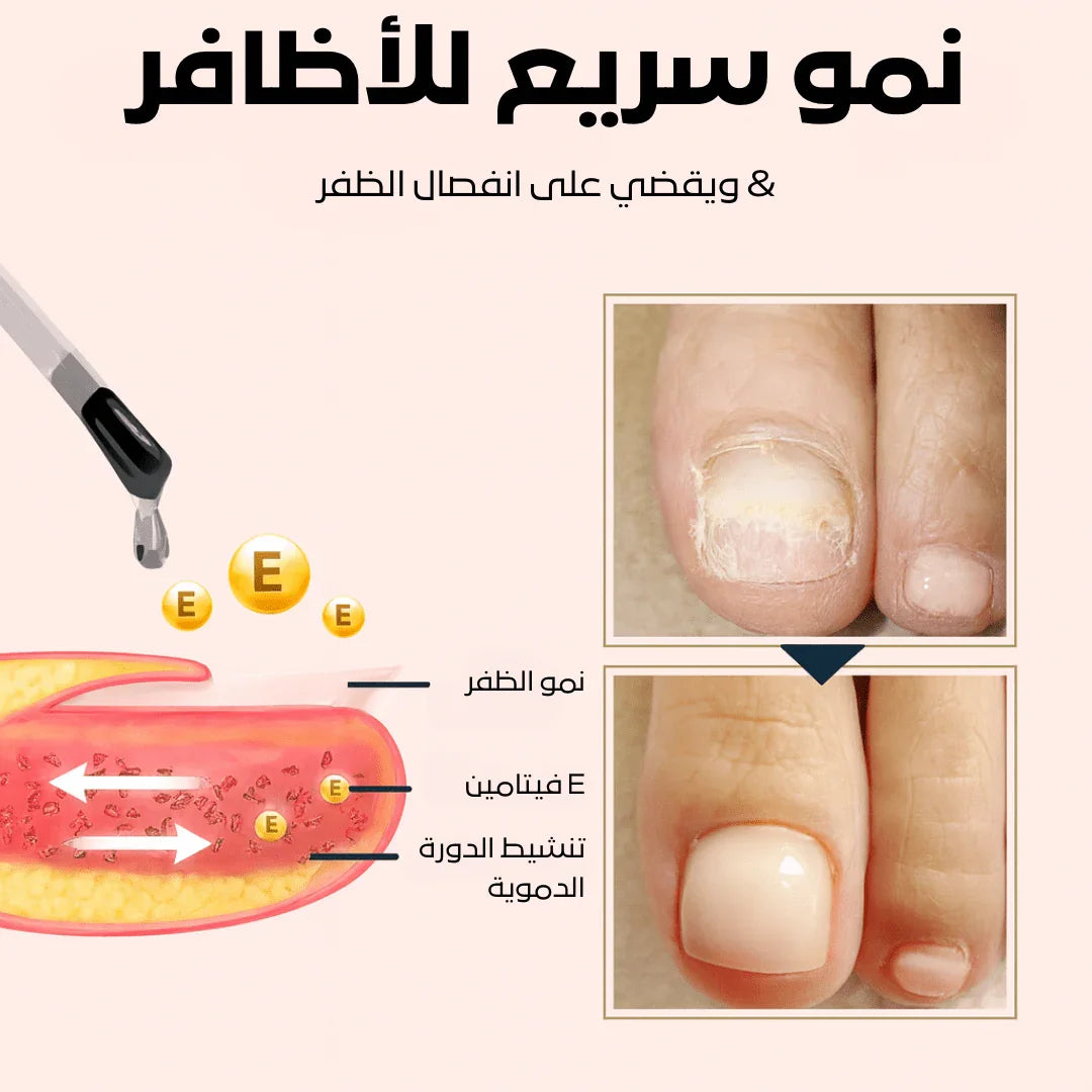 سيروم كيرا لنمو وإصلاح الأظافر التالفة – السر لعناية فائقة بالأظافر - aynaya ❤️