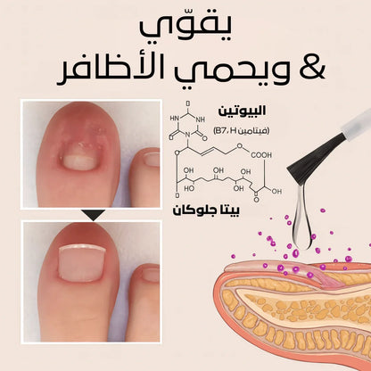 سيروم كيرا لنمو وإصلاح الأظافر التالفة – السر لعناية فائقة بالأظافر - aynaya ❤️